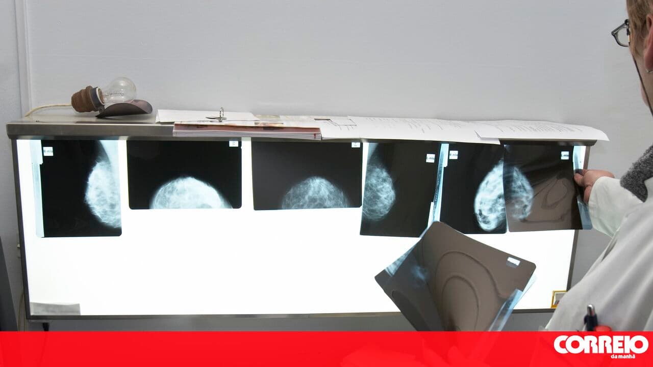 SNS pays rates 50% lower than ADSE to contracted radiology providers