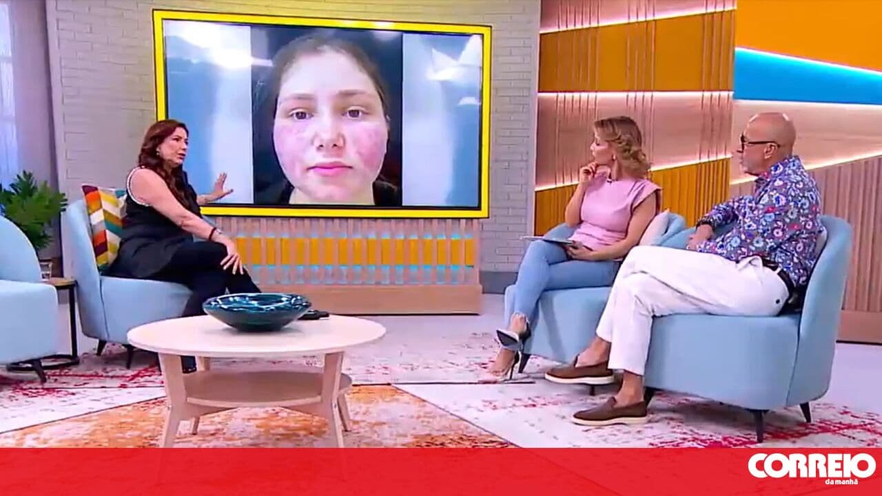 Do you know what Rosacea is? Doctor Alexandra Osório explains what you need to know