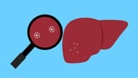 WHO warns that viral hepatitis remains a "global challenge" despite progress