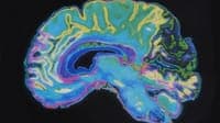 Bitter taste receptors may increase the effectiveness of aggressive brain tumour treatment