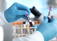 Carbon dioxide levels are higher than at any point experienced by humans. This may be altering our blood chemistry
