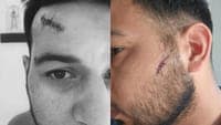 Iraqi refugee assaulted and robbed by a group of youths in Lisbon. PSP searching for suspects