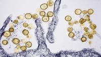 Virus of "high transmissibility" is the "most likely agent" to have caused gastroenteritis outbreak in Faial