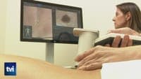 Three IPO patients participate in a "revolutionary" clinical trial to test a melanoma vaccine