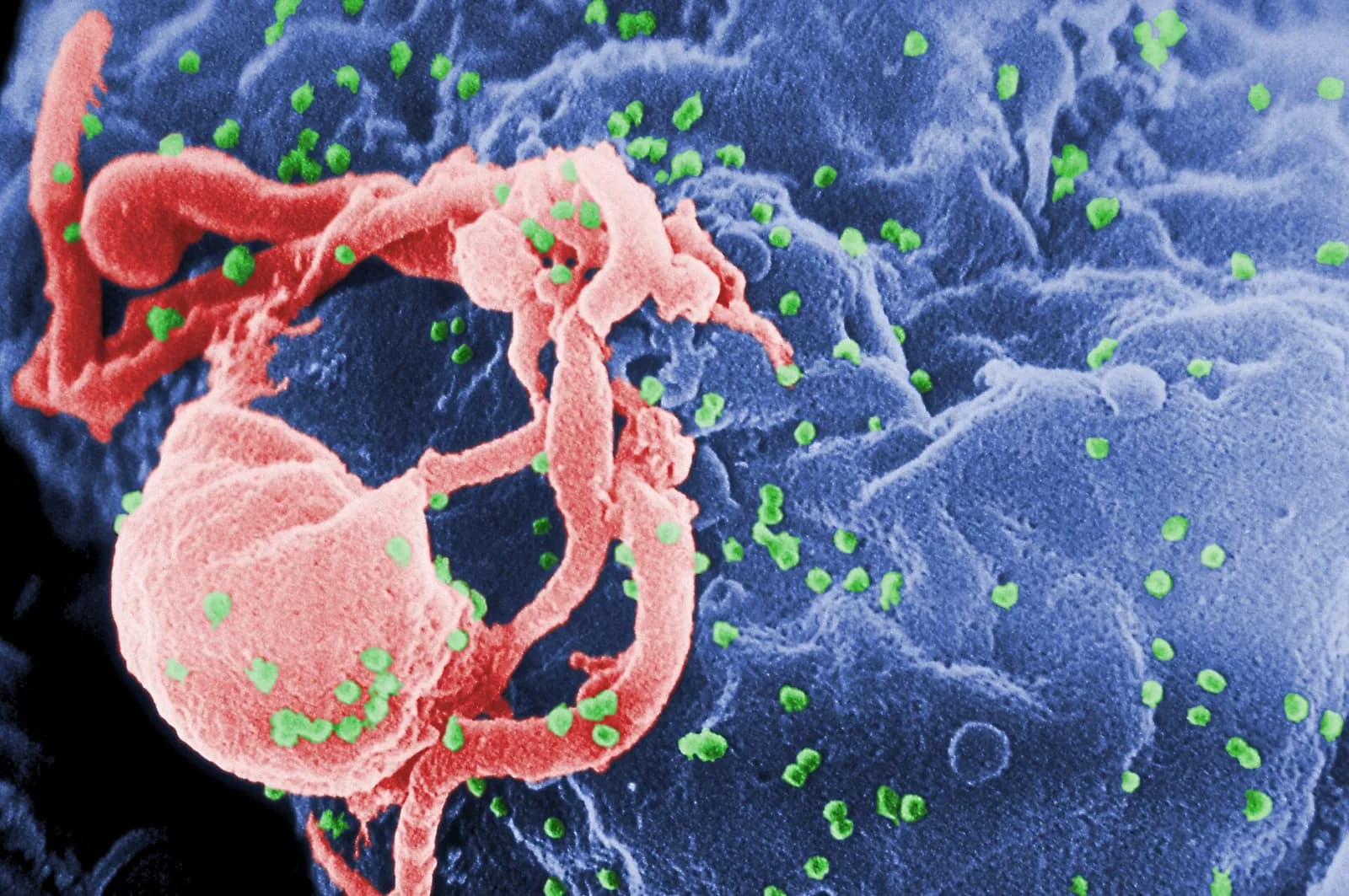 A false-colour microscope image of a blue cell surface dotted with small green particles, with a pink rounded cell and tangled pink strands at the left.