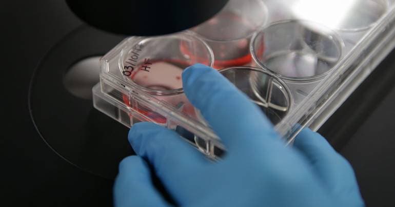 Coimbra discovers protein's role in epilepsy