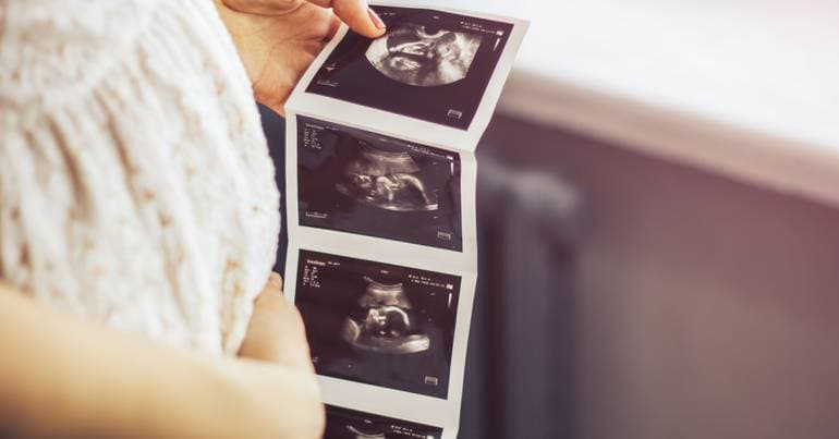 UN: extreme heat threatens the safety of pregnancy and childbirth