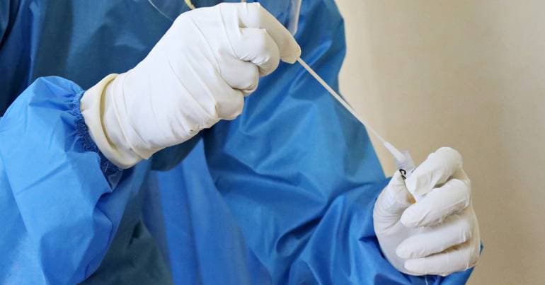 Dangerous virus samples stolen from university