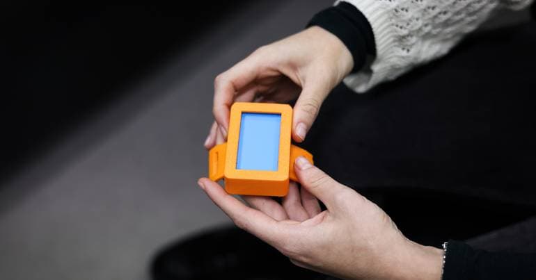 How 3D Printing is Revolutionising the Healthcare Sector