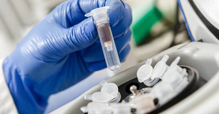 Person of Portuguese descent creates 'Trojan horse' to treat cancers