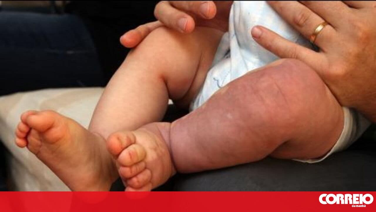 Infant mortality in Portugal at levels of poor countries in several municipalities