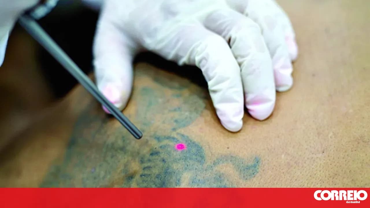 Unregulated tattoo removal is on the rise