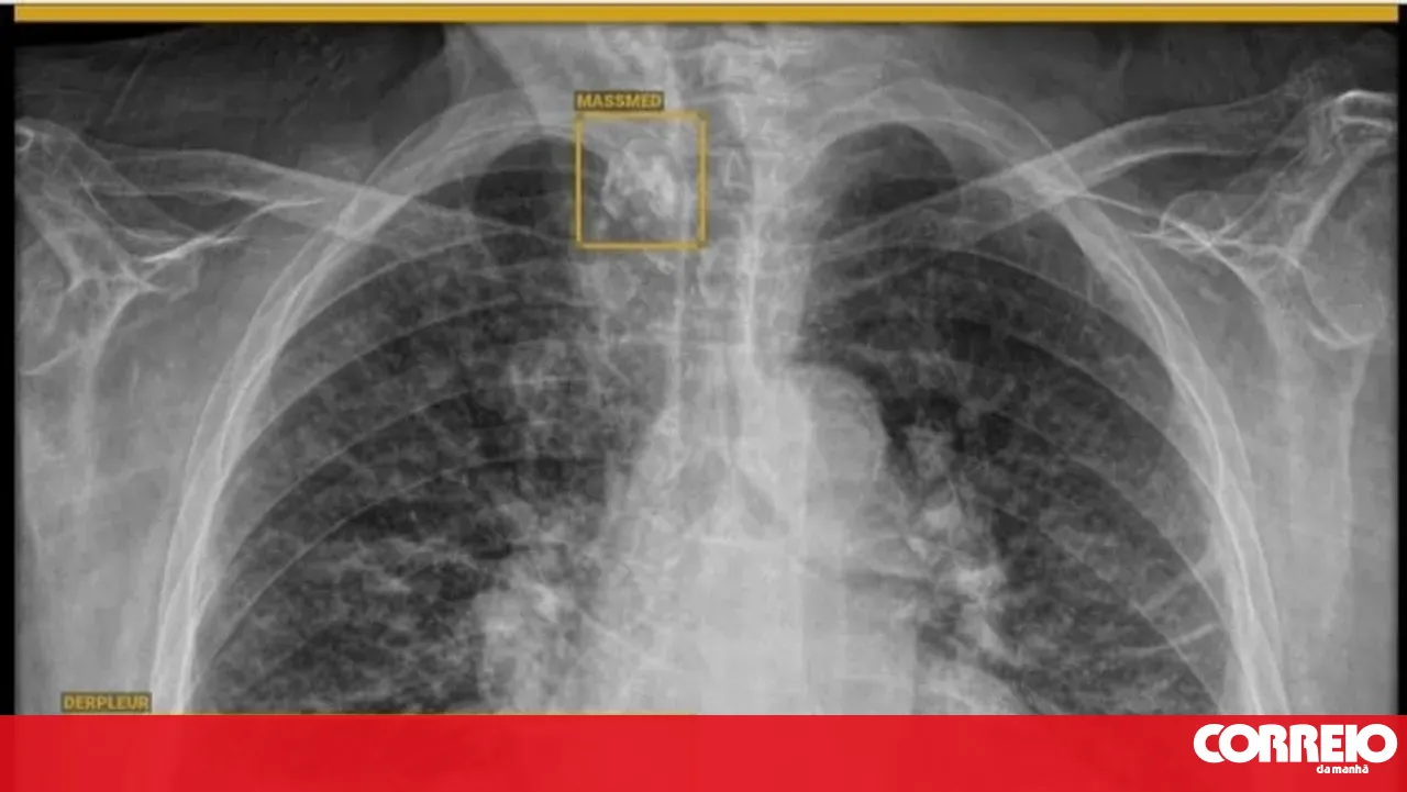 Patients travel for nearly two hours to get an X-ray