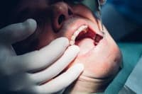 Special career path for dentists in the NHS published