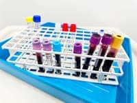 Coimbra's Queima das Fitas sets up tent to test for sexually transmitted diseases