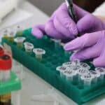 Coimbra tests blood marker to speed up Alzheimer’s diagnosis